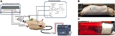 Feature Selection Techniques for a Machine Learning Model to Detect Autonomic Dysreflexia